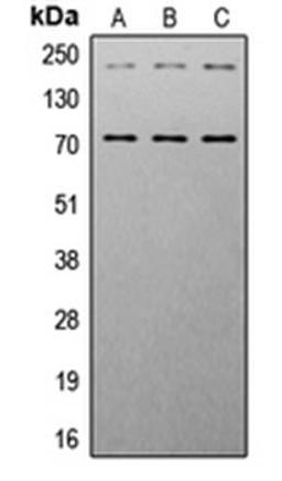Western blot analysis of HeLa (Lane 1), NIH3T3 (Lane 2), mouse heart (Lane 3) whole cell lysates using IGF1 Receptor (phospho-Y1161) antibody