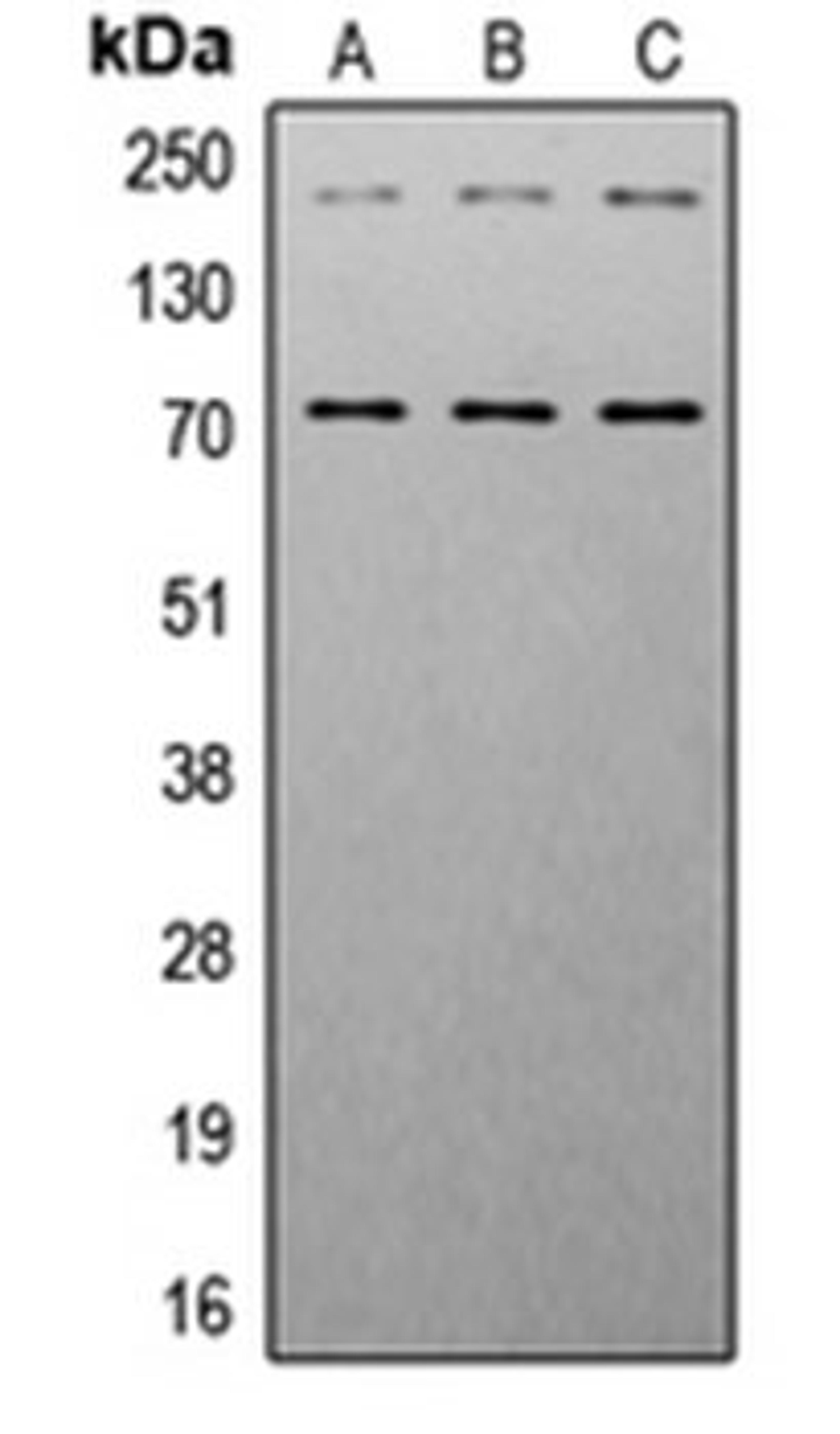 Western blot analysis of HeLa (Lane 1), NIH3T3 (Lane 2), mouse heart (Lane 3) whole cell lysates using IGF1 Receptor (phospho-Y1161) antibody