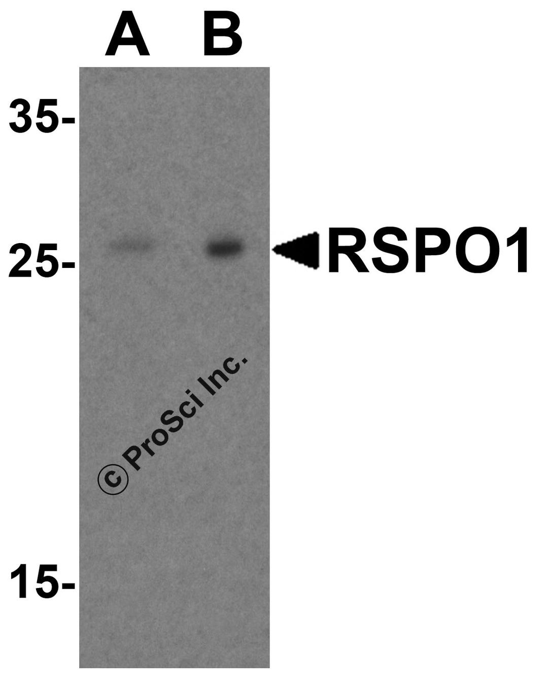 Western blot analysis of RSPO1 in human heart tissue lysate with RSPO1 antibody at (A) 1 and (B) 2 μg/mL.