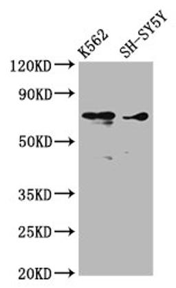 Western Blot. Positive WB detected in: K562 whole cell lysate, SH-SY5Y whole cell lysate. All lanes: ALOX12 antibody at 3.53µg/ml. Secondary. Goat polyclonal to rabbit IgG at 1/50000 dilution. Predicted band size: 76 kDa. Observed band size: 76 kDa