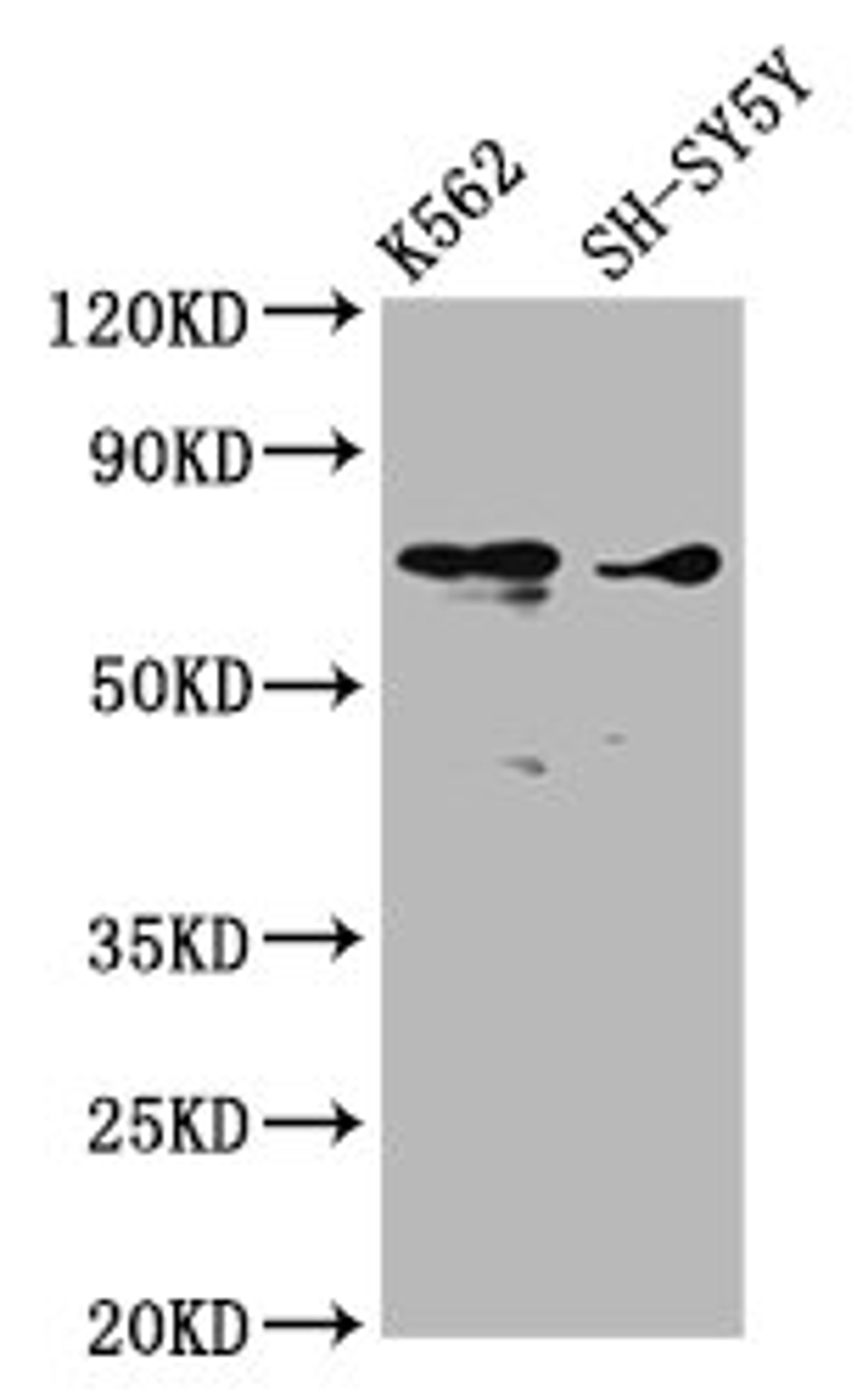 Western Blot. Positive WB detected in: K562 whole cell lysate, SH-SY5Y whole cell lysate. All lanes: ALOX12 antibody at 3.53µg/ml. Secondary. Goat polyclonal to rabbit IgG at 1/50000 dilution. Predicted band size: 76 kDa. Observed band size: 76 kDa