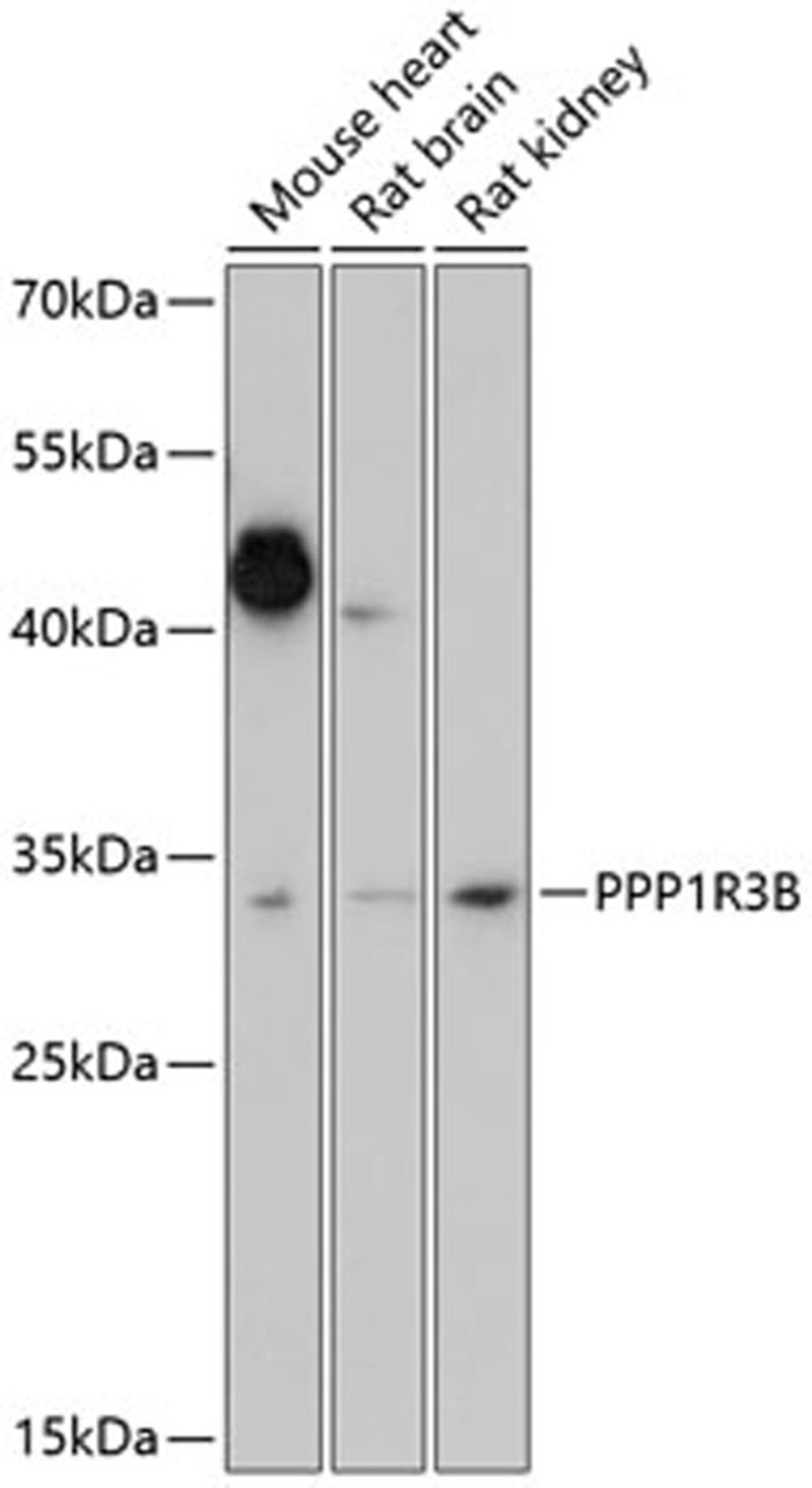 Western blot - PPP1R3B antibody (A14931)