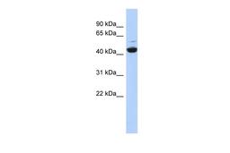 Antibody used in WB on Human HepG2 at 0.2-1 ug/ml.