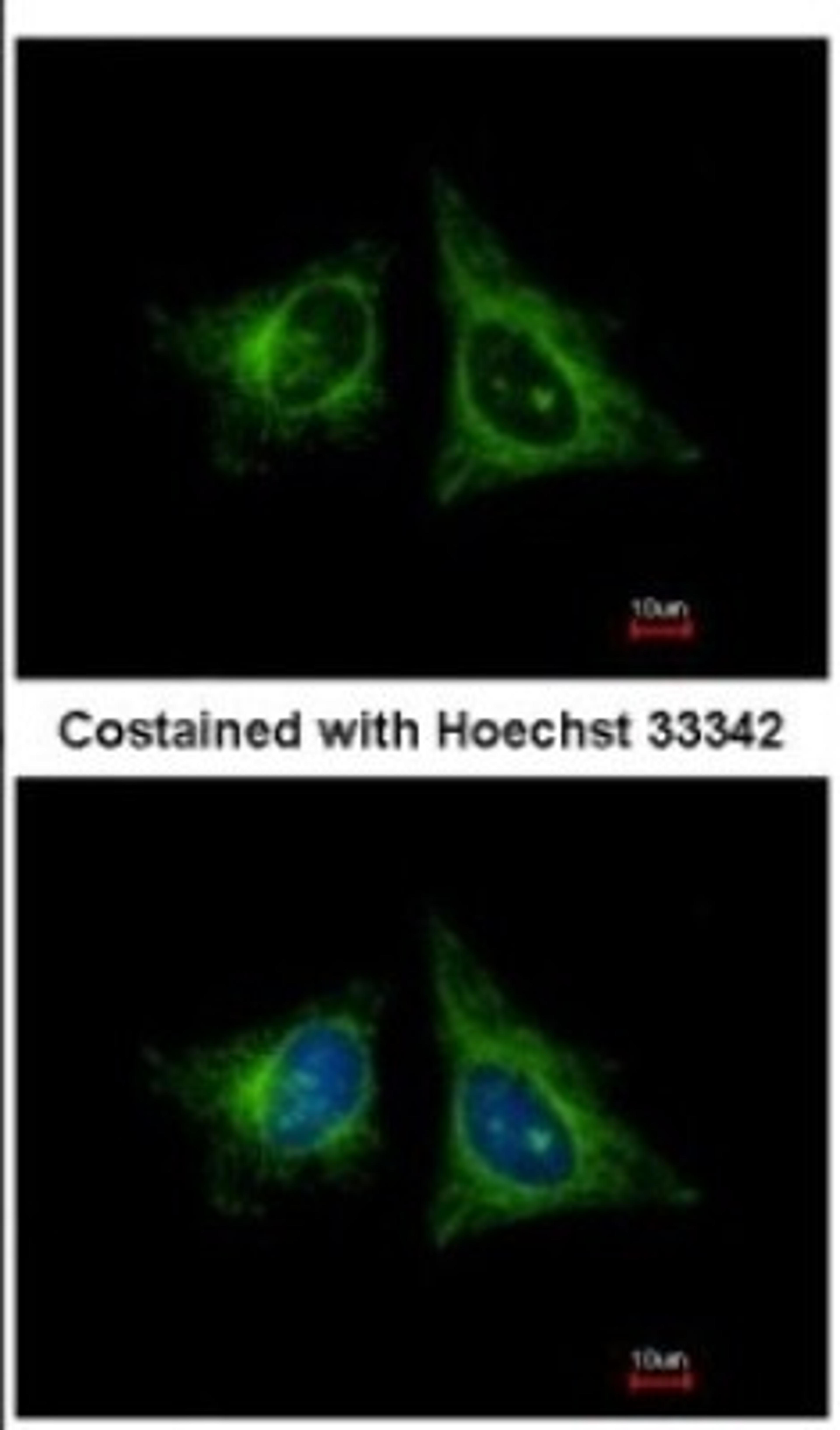 Immunocytochemistry/Immunofluorescence: HEBP1 Antibody [NBP2-14977] - Analysis of methanol-fixed HeLa, using HEBP1 antibody at 1:400 dilution.