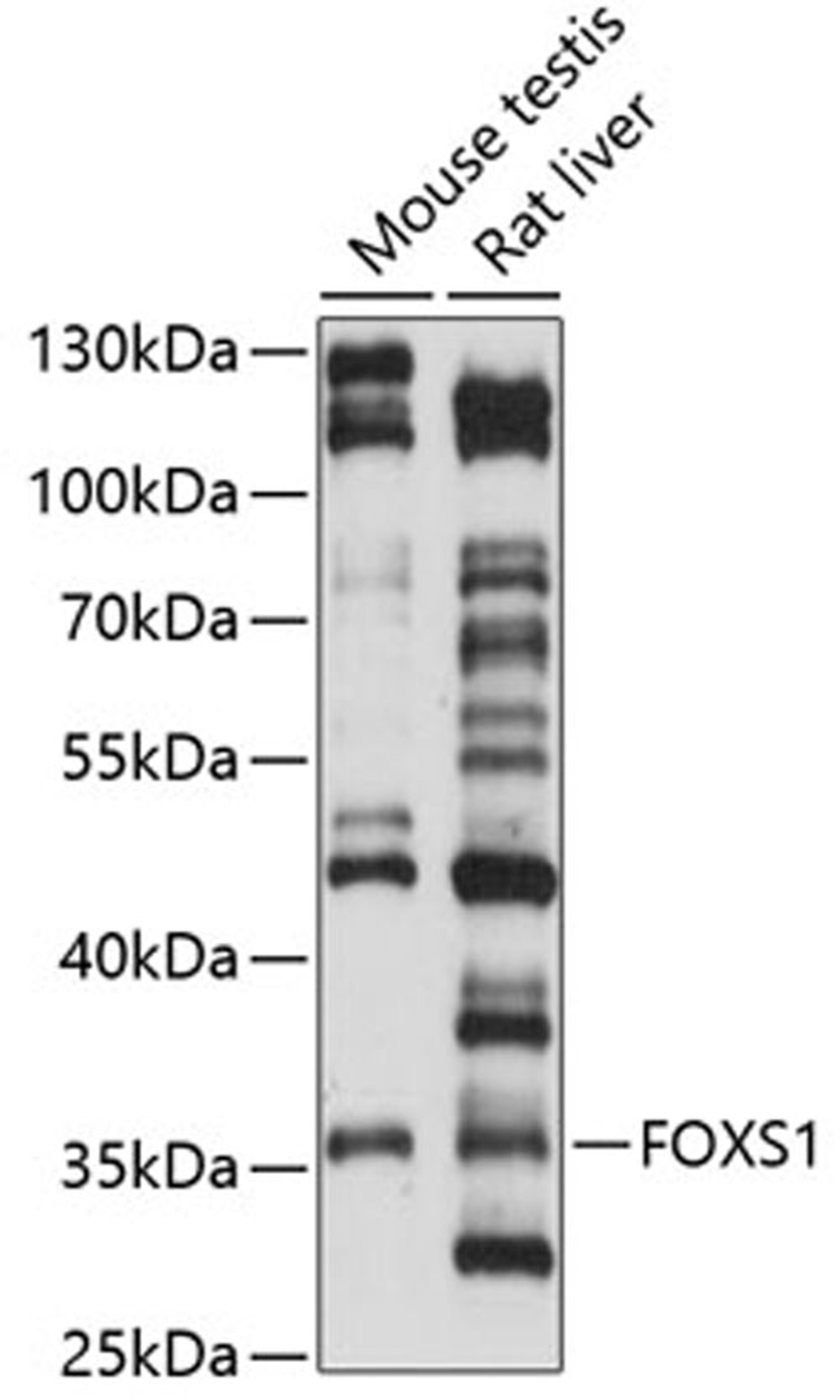 Western blot - FOXS1 antibody (A14732)