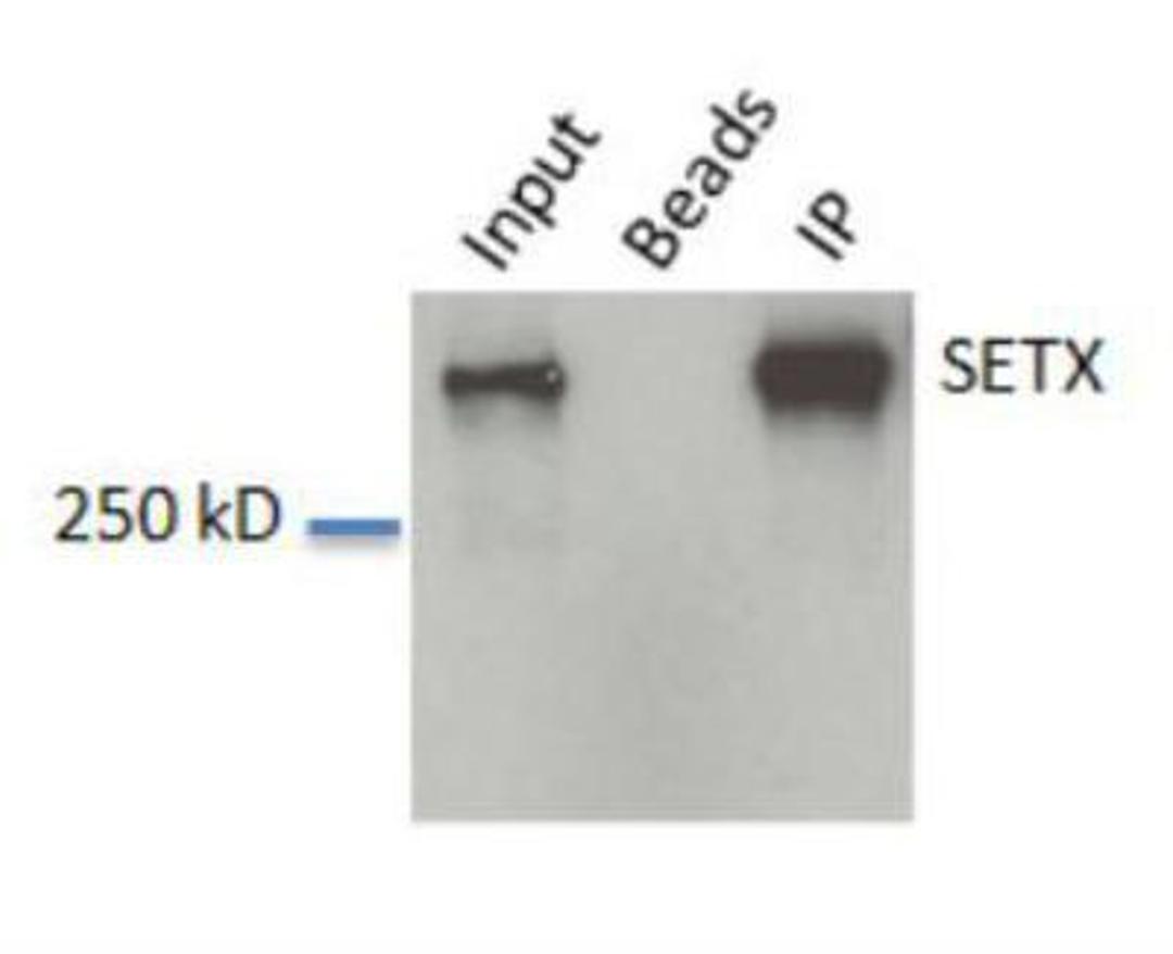 Western Blot: Senataxin Antibody [NBP1-94712] - WB analysis of Senataxin in: A. HeLa whole cell lysate, B. Beads without antibody IP control and C. IP from HeLa lysate.