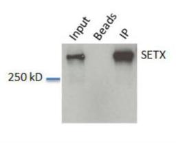 Western Blot: Senataxin Antibody [NBP1-94712] - WB analysis of Senataxin in: A. HeLa whole cell lysate, B. Beads without antibody IP control and C. IP from HeLa lysate.