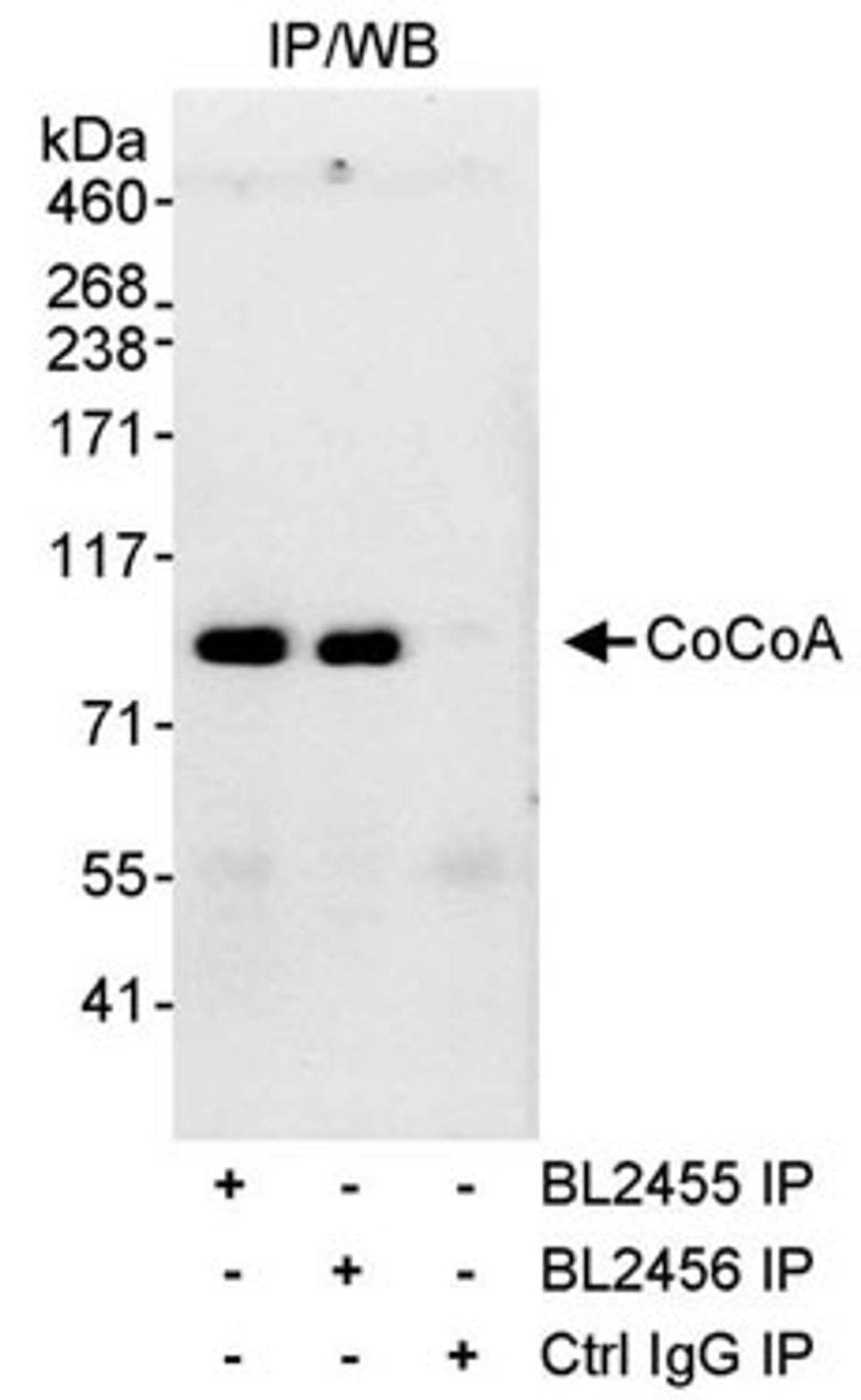 Detection of human CoCoA by western blot of immunoprecipitates.