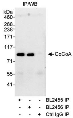 Detection of human CoCoA by western blot of immunoprecipitates.