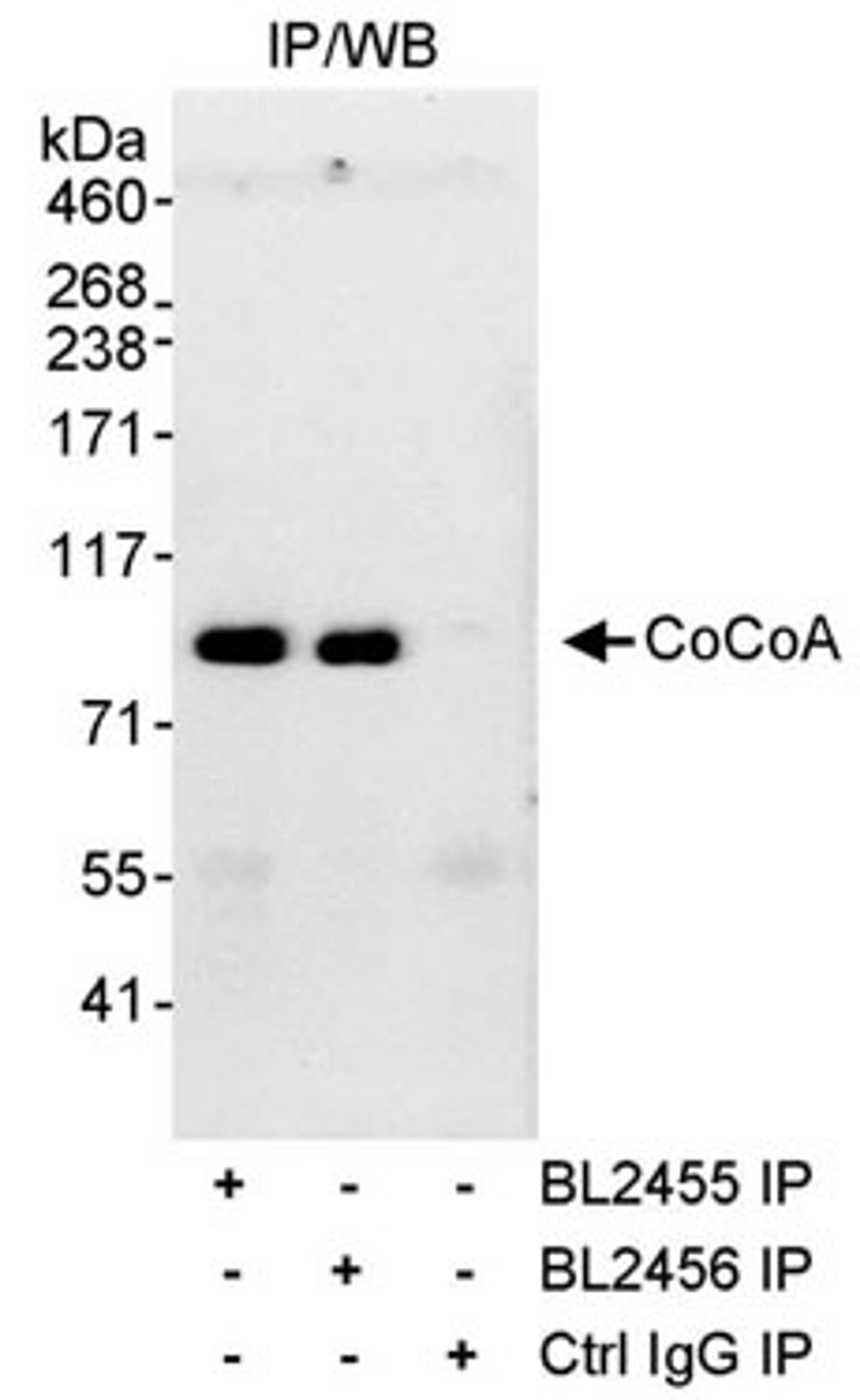 Detection of human CoCoA by western blot of immunoprecipitates.