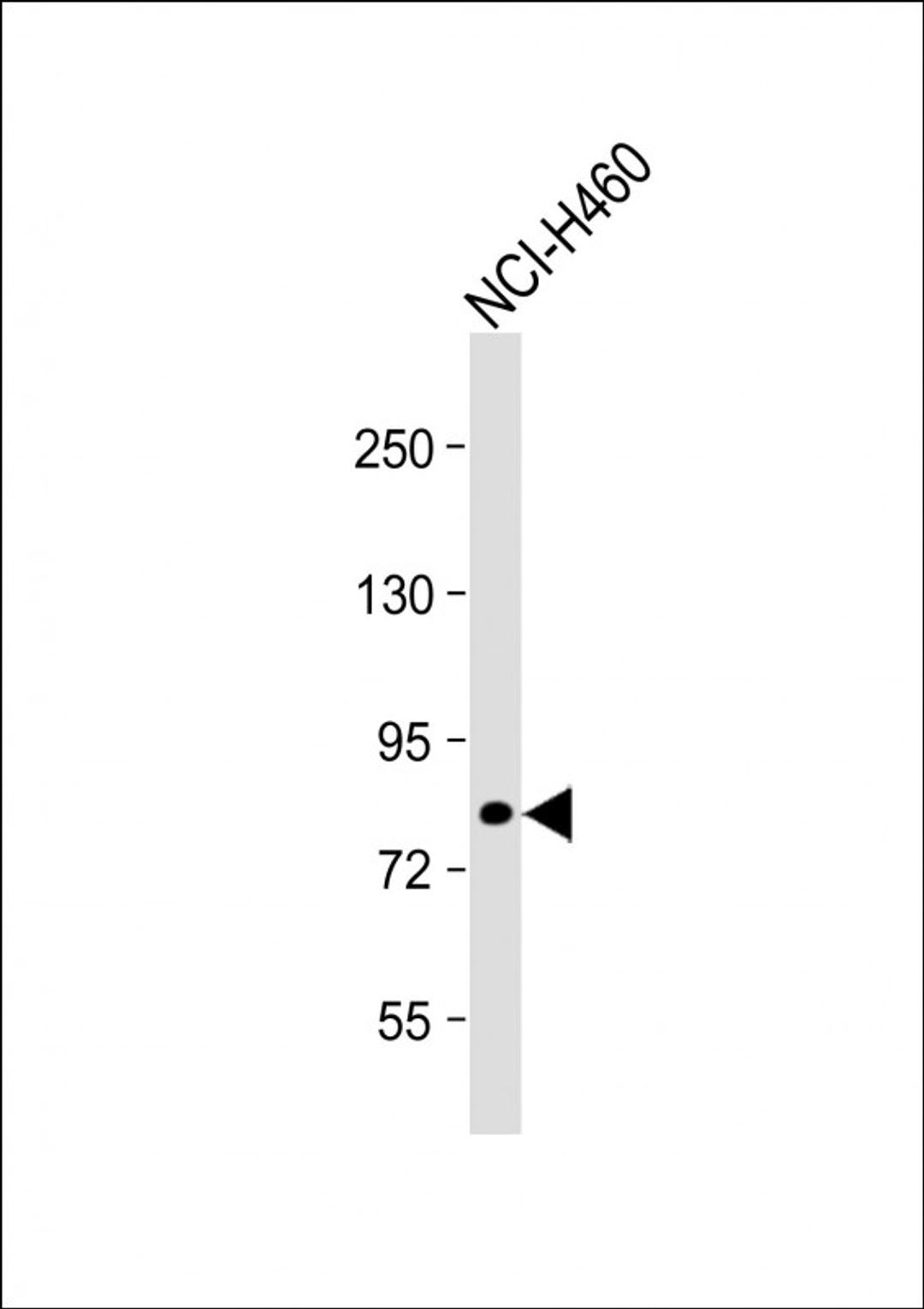 Western Blot at 1:1000 dilution + NCI-H460 whole cell lysate Lysates/proteins at 20 ug per lane.