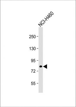 Western Blot at 1:1000 dilution + NCI-H460 whole cell lysate Lysates/proteins at 20 ug per lane.