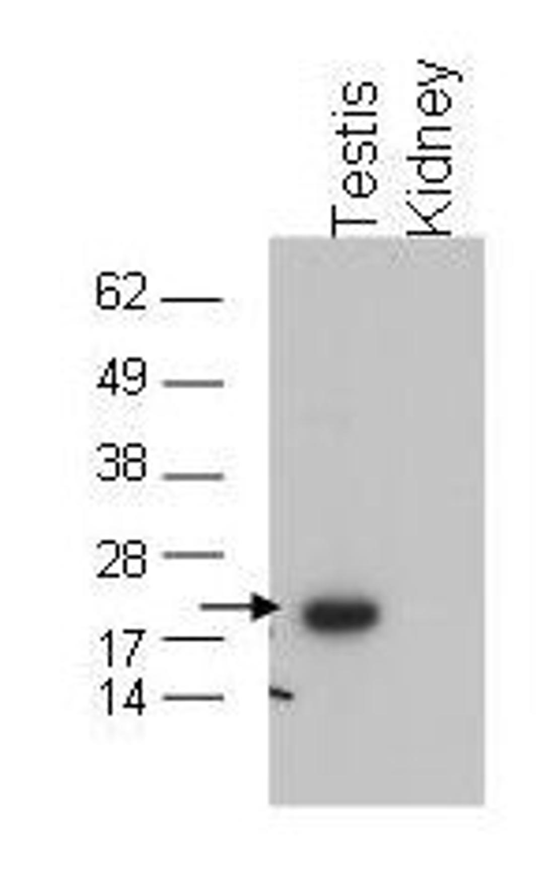 Western blot analysis of testis extract (arrow). Tissue extract (40 ug) was electrophoresed and transferred to nitrocellulose using Glutathione 4 antibody