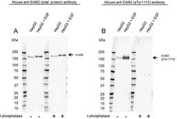 Western Blot analysis of HepG2 untreated and EGF treated whole cell lysates