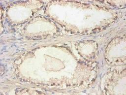 Immunohistochemical of paraffin-embedded human prostate tissue using CSB-MA061901A0m at dilution of 1:200