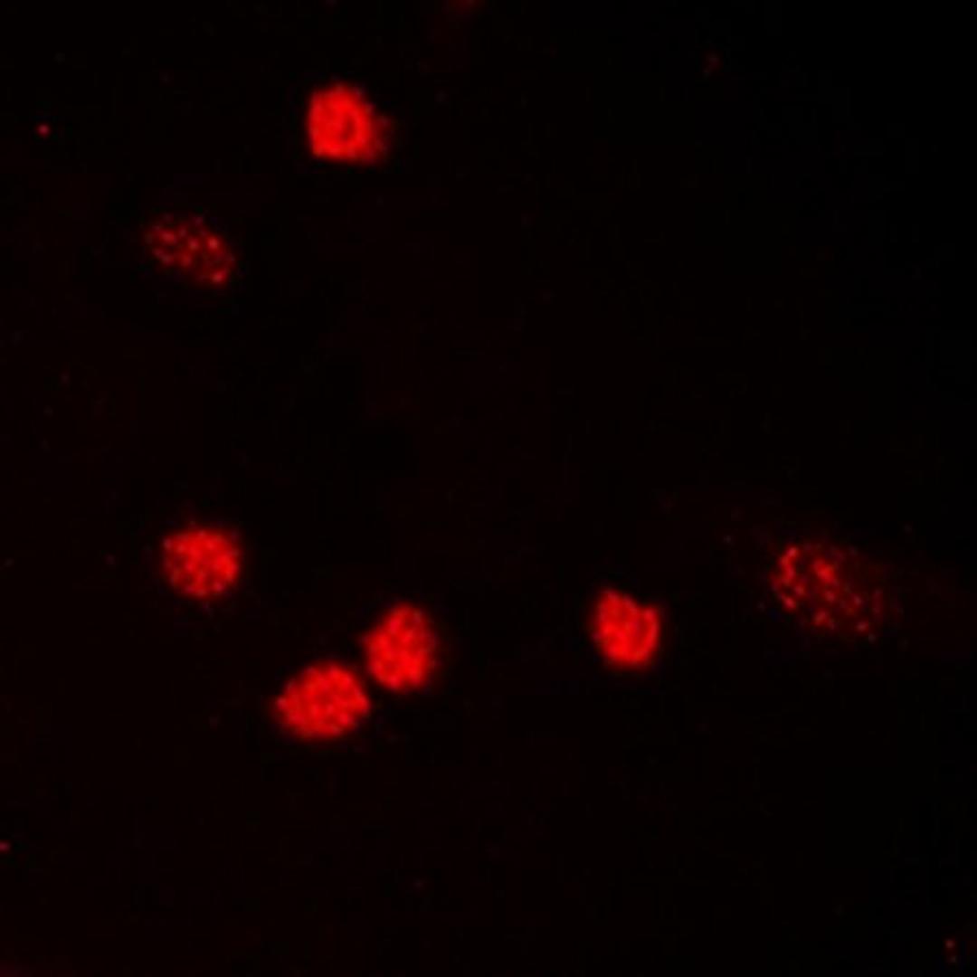 Immunofluorescense analysis of HeLa cells using p53 (AcK319) antibody