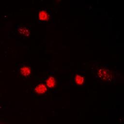 Immunofluorescense analysis of HeLa cells using p53 (AcK319) antibody