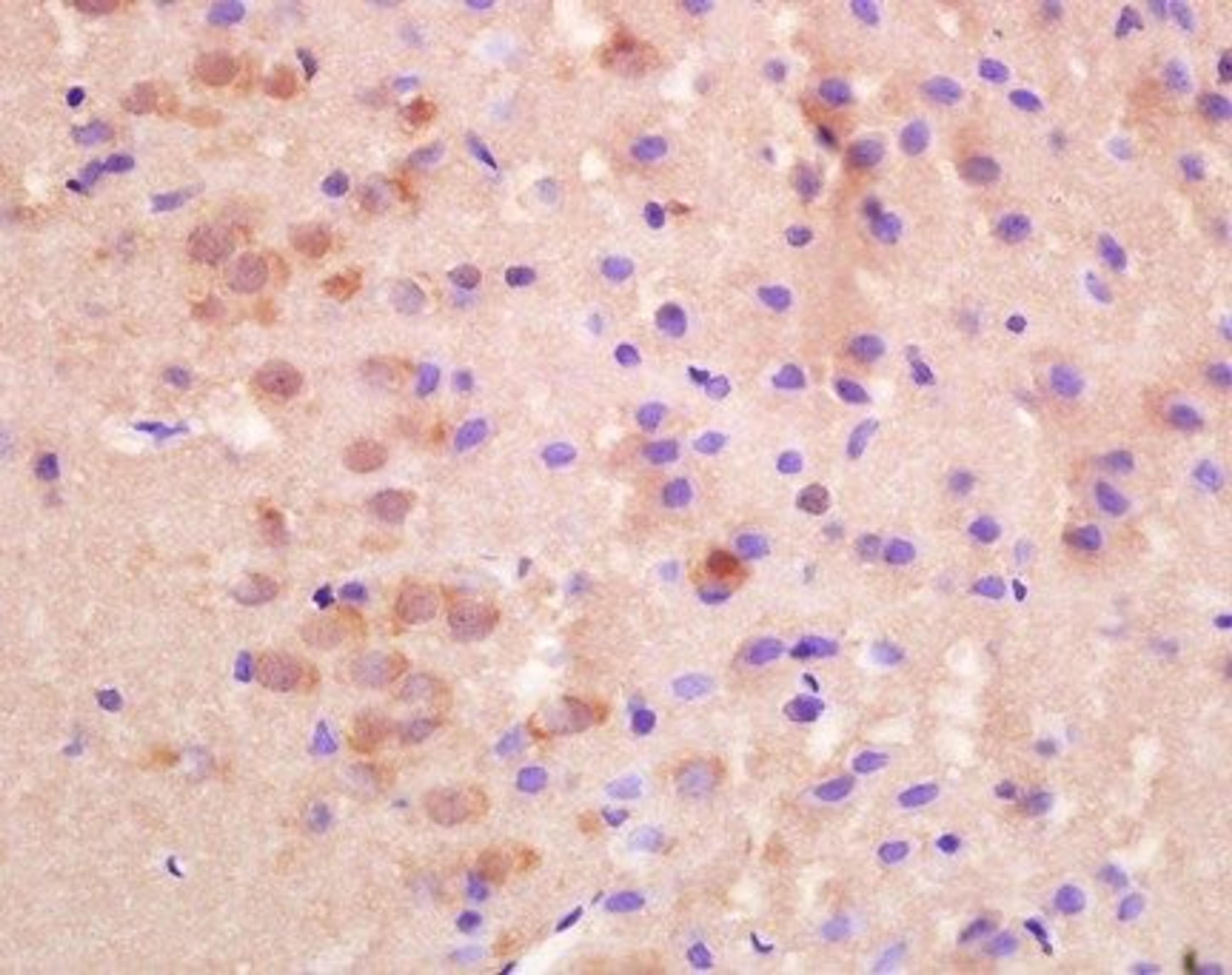 Immunohistochemical analysis of paraffin embedded and 4% Paraformaldehyde-fixed  rat brain tissue using  SLC8A2 antibody 