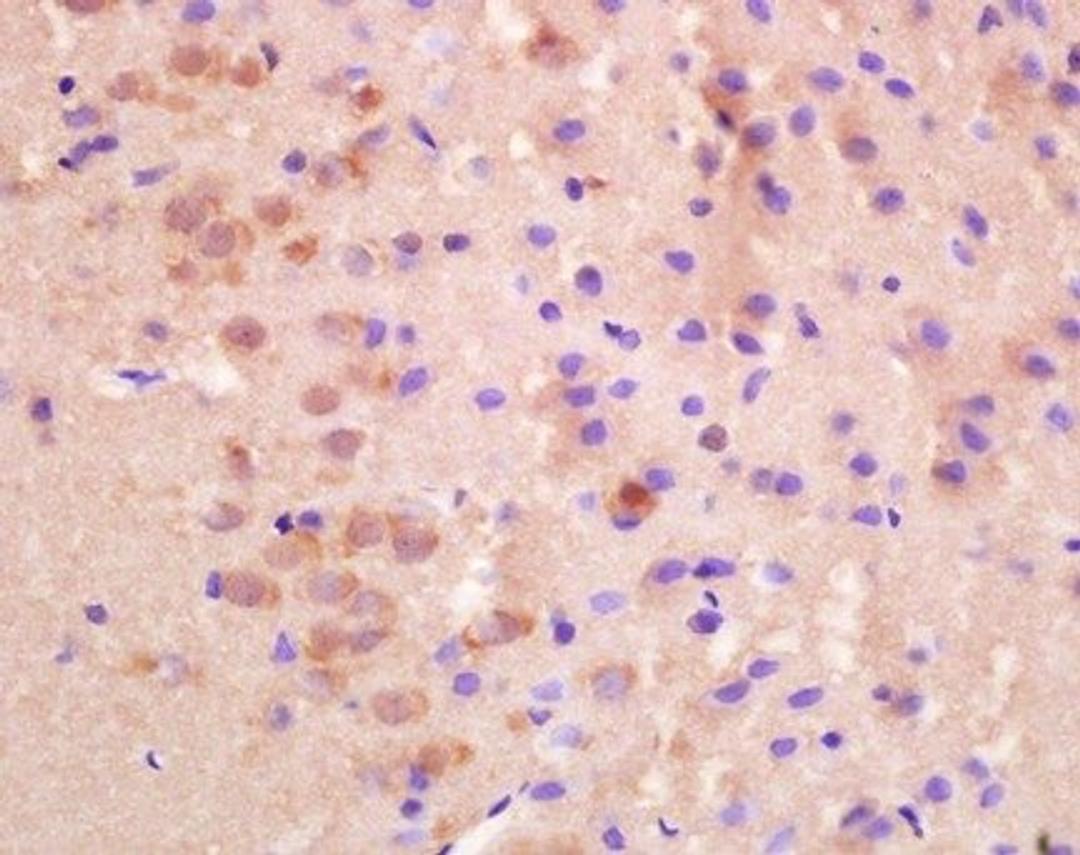 Immunohistochemical analysis of paraffin embedded and 4% Paraformaldehyde-fixed rat brain tissue using SLC8A2 antibody