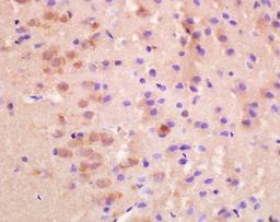 Immunohistochemical analysis of paraffin embedded and 4% Paraformaldehyde-fixed rat brain tissue using SLC8A2 antibody