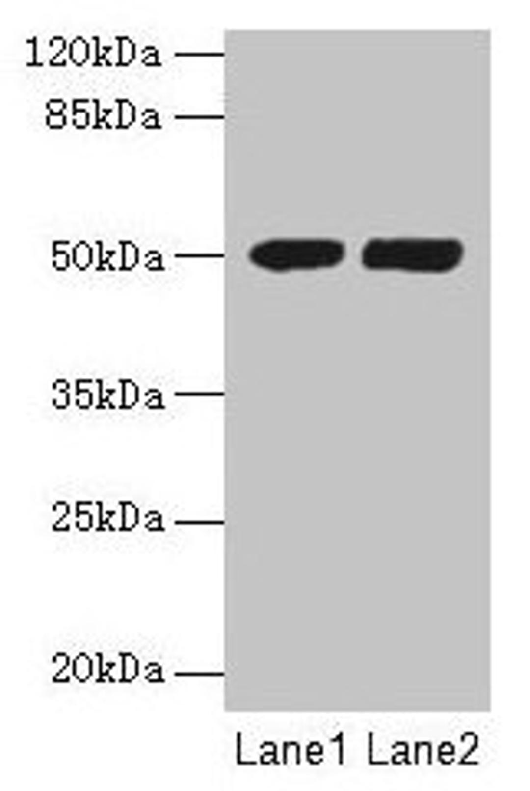 Western blot. All lanes: TUBA3E antibody at 3µg/ml. Lane 1: MCF-7 whole cell lysate. Lane 2: Hela whole cell lysate. Secondary. Goat polyclonal to rabbit IgG at 1/10000 dilution. Predicted band size: 50 kDa. Observed band size: 50 kDa