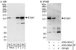 Detection of human E-Syt1 by western blot and immunoprecipitation.