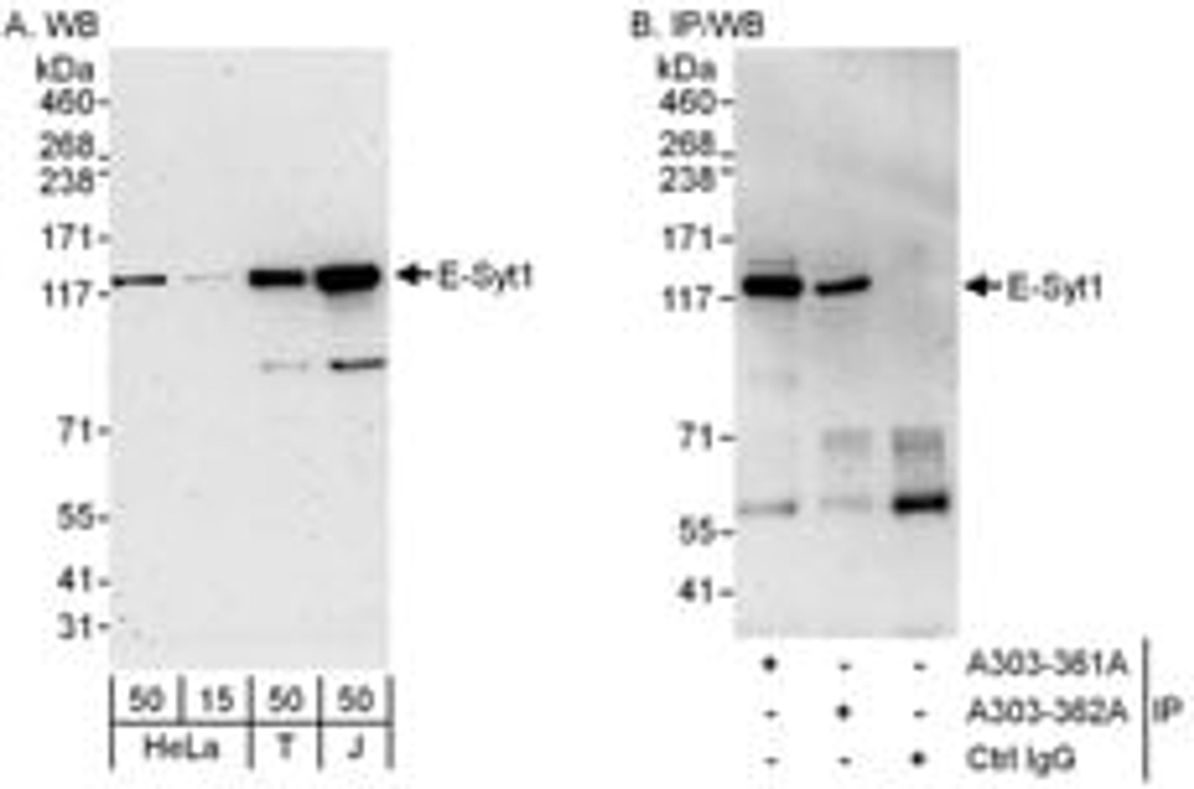 Detection of human E-Syt1 by western blot and immunoprecipitation.