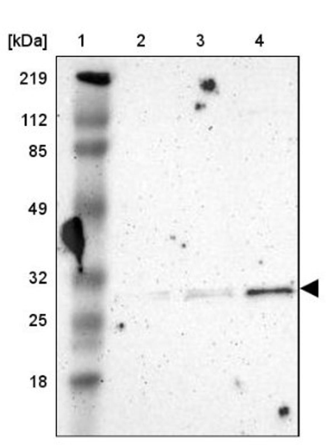 Western Blot: CXorf21 Antibody [NBP1-82317] - Lane 1: Marker [kDa] 219, 112, 85, 49, 32, 25, 18<br/>Lane 2: Human cell line RT-4<br/>Lane 3: Human cell line U-251MG sp<br/>Lane 4: Human cell line A-431