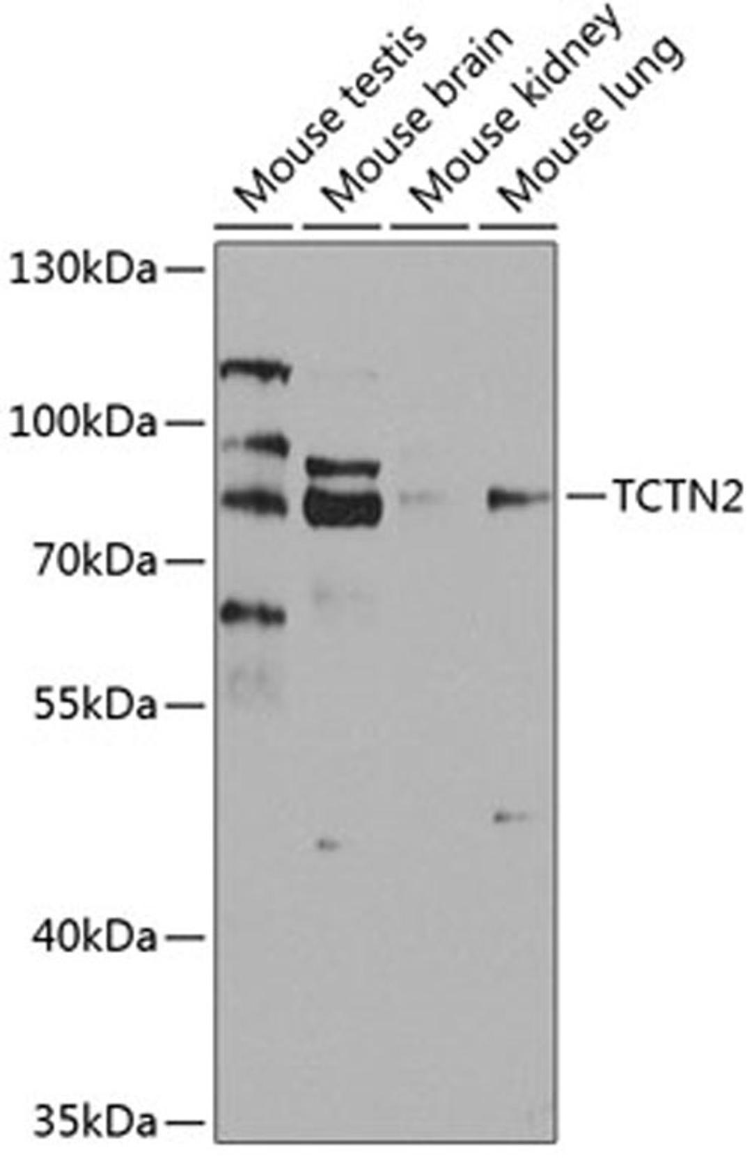 Western blot - TCTN2 antibody (A8260)