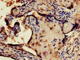 Immunohistochemistry of paraffin-embedded human placenta tissue using CSB-PA757785LA01HU at dilution of 1:100