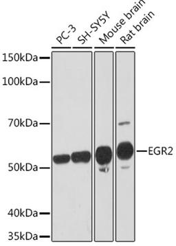 Western blot - EGR2 Rabbit mAb (A3219)