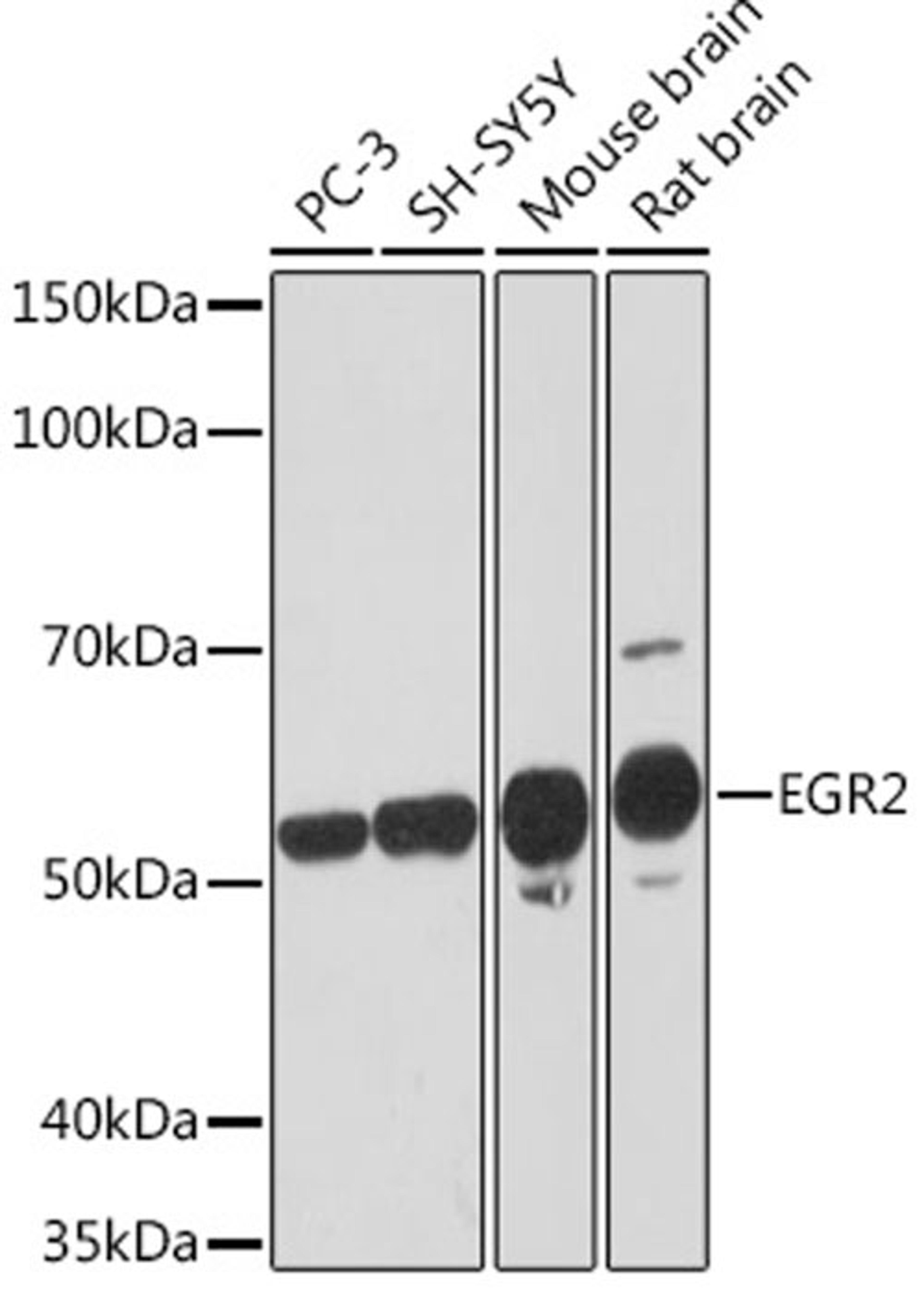 Western blot - EGR2 Rabbit mAb (A3219)