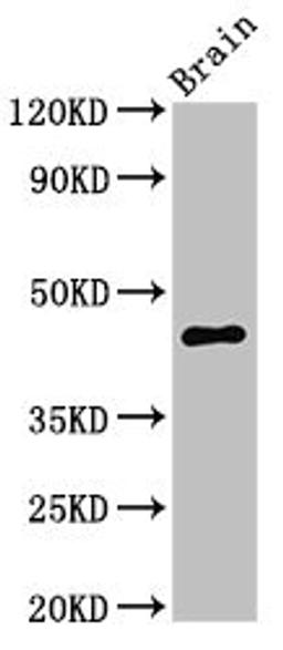 Western Blot. Positive WB detected in: Mouse brain tissue. All lanes: UHMK1 antibody at 3ug/ml. Secondary. Goat polyclonal to rabbit IgG at 1/50000 dilution. Predicted band size: 47, 39, 40 kDa. Observed band size: 47 kDa. 
