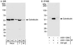 Detection of human and mouse Calreticulin by western blot (h&m) and immunoprecipitation (h).