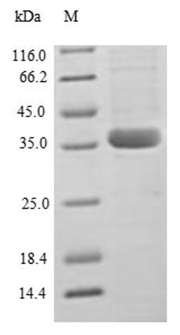 (Tris-Glycine gel) Discontinuous SDS-PAGE (reduced) with 5% enrichment gel and 15% separation gel.