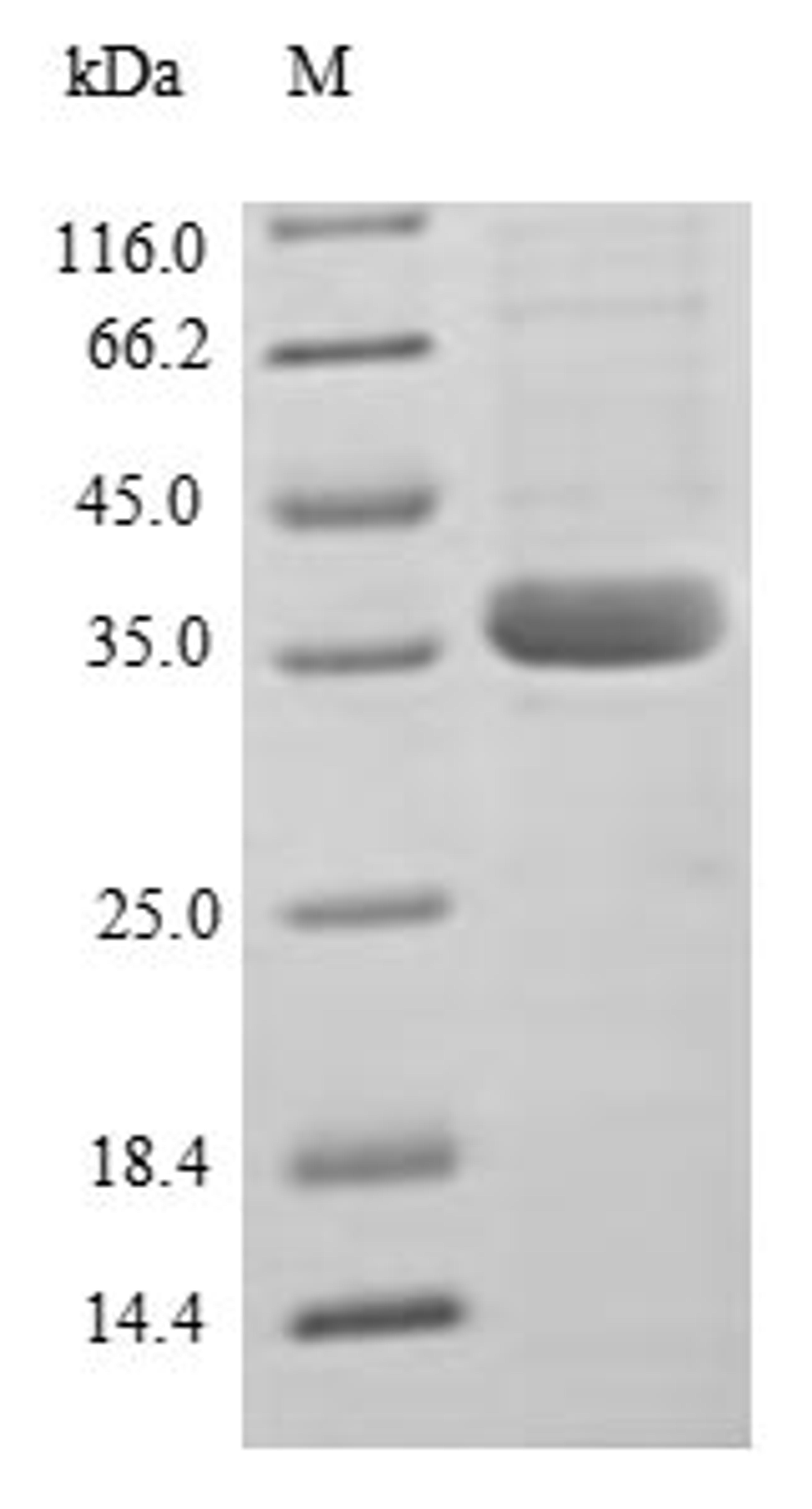 (Tris-Glycine gel) Discontinuous SDS-PAGE (reduced) with 5% enrichment gel and 15% separation gel.