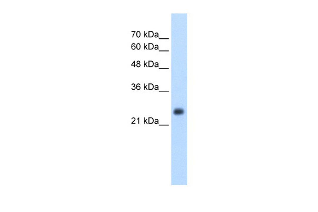 Antibody used in WB on Human HepG2 at 2.5 ug/ml.