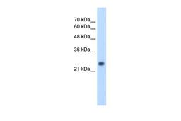 Antibody used in WB on Human HepG2 at 2.5 ug/ml.