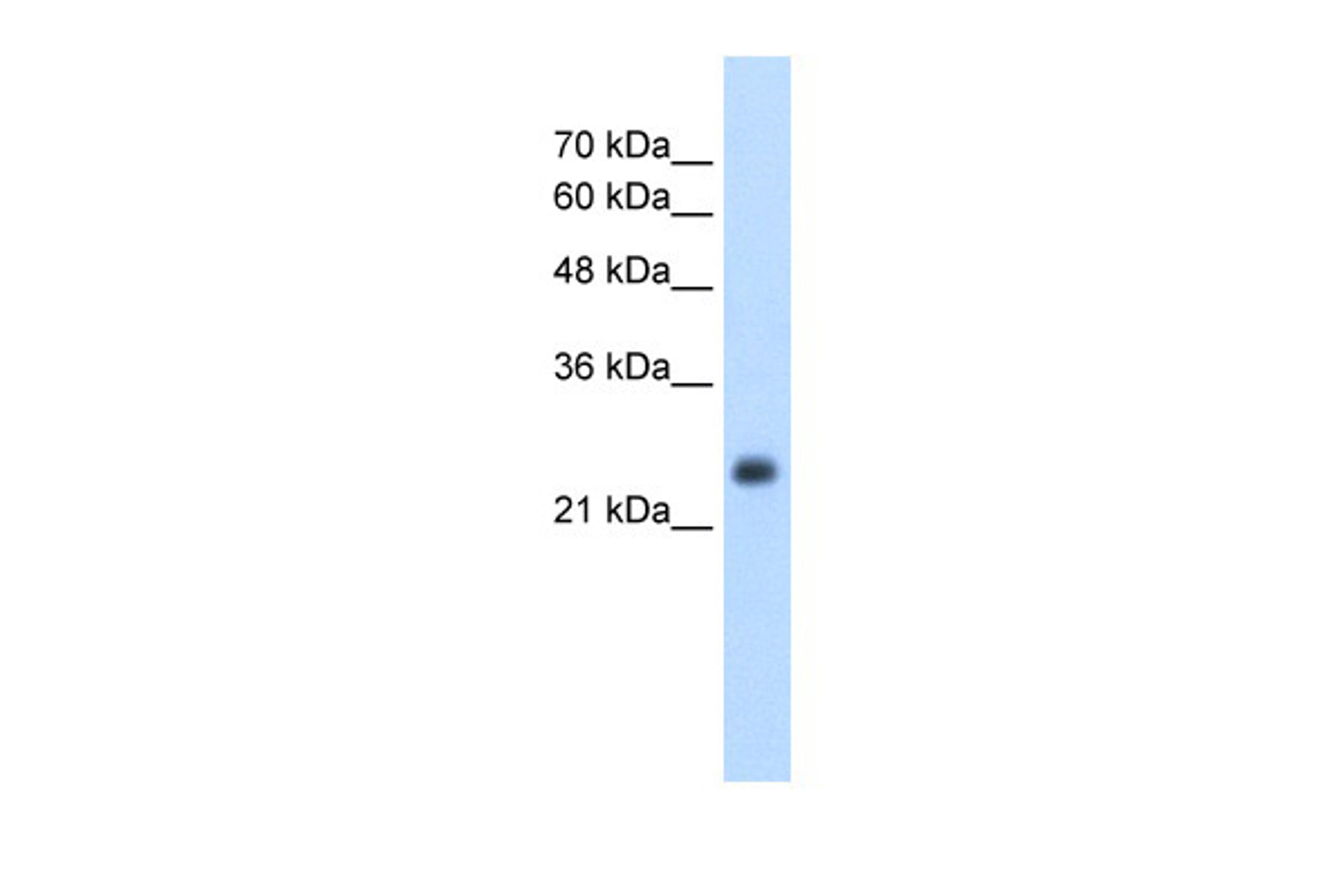 Antibody used in WB on Human HepG2 at 2.5 ug/ml.