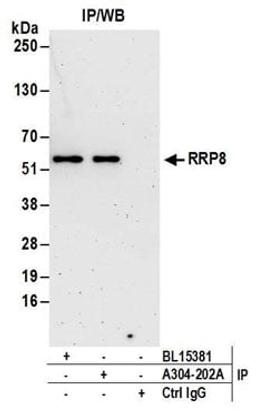 Detection of human RRP8 by western blot of immunoprecipitates.