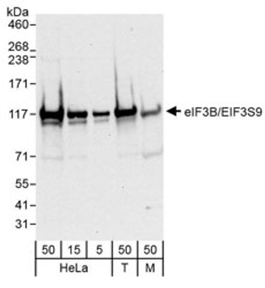 Detection of human and mouse eIF3B/EIF3S9 by western blot.