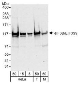 Detection of human and mouse eIF3B/EIF3S9 by western blot.