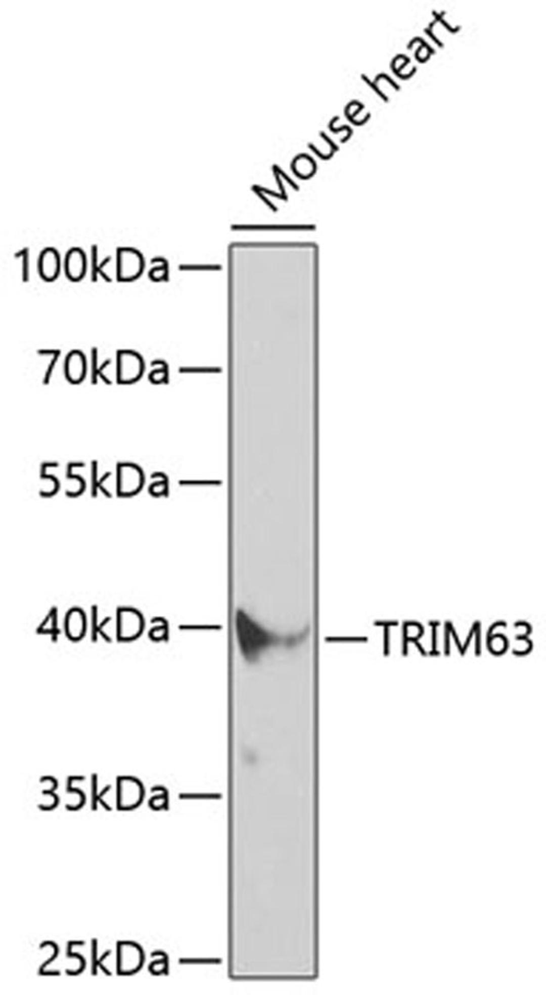 Western blot - TRIM63 antibody (A3101)