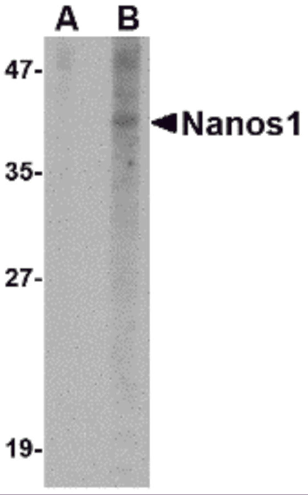 Western blot analysis of Nanos1 in SK-N-SH cell lysate with Nanos1 antibody at 1 μg/mL in (A) the presence and (B) the absence of blocking peptide.