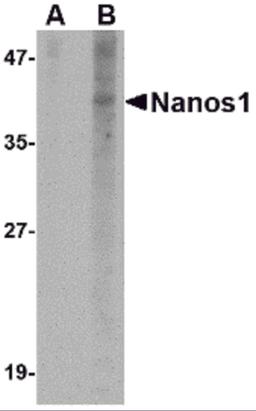 Western blot analysis of Nanos1 in SK-N-SH cell lysate with Nanos1 antibody at 1 μg/mL in (A) the presence and (B) the absence of blocking peptide.