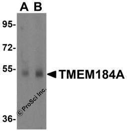 Western blot analysis of TMEM184A in rat brain tissue lysate with TMEM184A antibody at 1 μg/mL in (A) the absence and (B) the presence of blocking peptide.