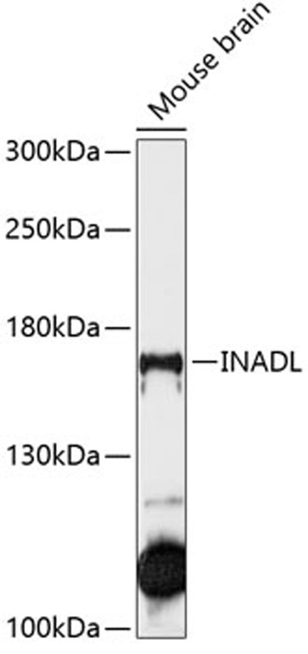 Western blot - INADL antibody (A12063)