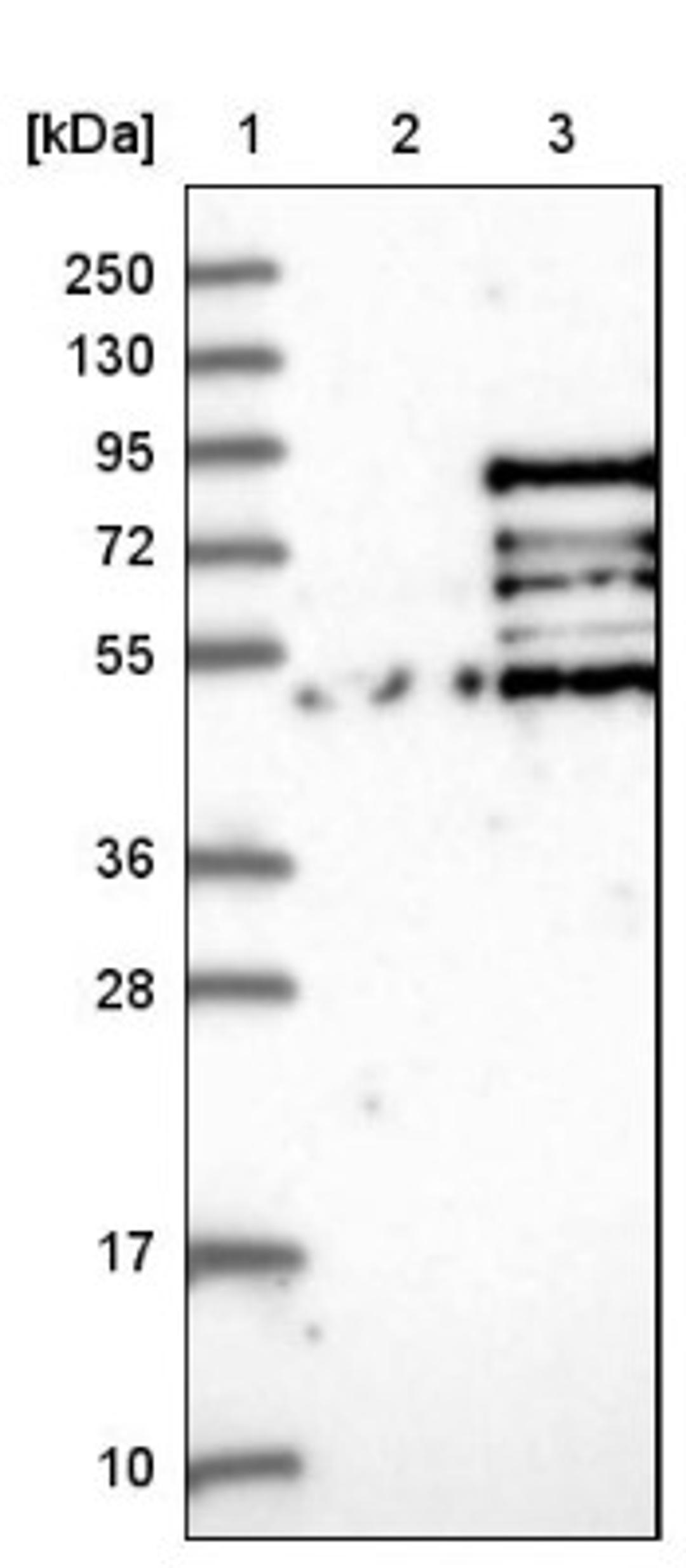 Western Blot: MSL2L1 Antibody [NBP1-83853] - Lane 1: Marker [kDa] 250, 130, 95, 72, 55, 36, 28, 17, 10<br/>Lane 2: Negative control (vector only transfected HEK293T lysate)<br/>Lane 3: Over-expression lysate (Co-expressed with a C-terminal myc-DDK tag (~3.1 kDa) in mammalian HEK293T cells, LY413286)