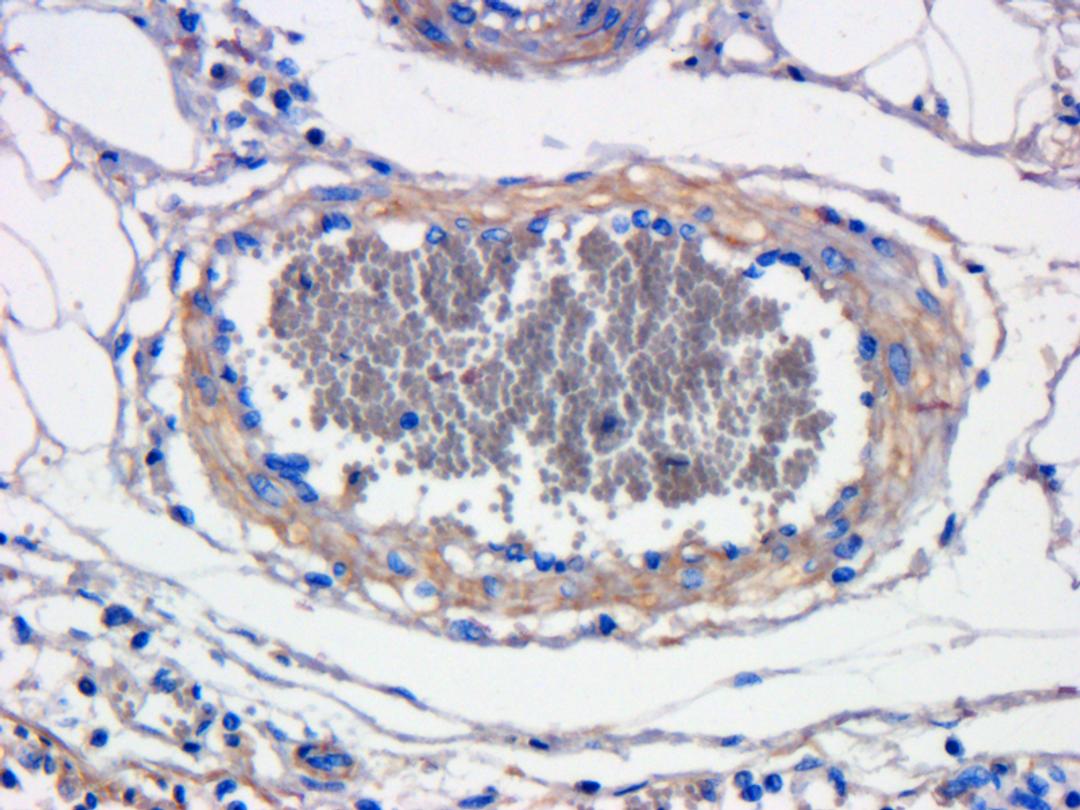 Immunohistochemical staining of pig large intestines vessel tissue using anti-CXCL11 (dilution of primary antibody - 1:100)