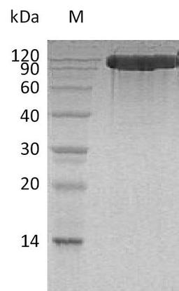 (Tris-Glycine gel) Discontinuous SDS-PAGE (reduced) with 5% enrichment gel and 15% separation gel.